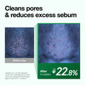 resultados / antes e depois do uso do oleo de limpeza da ANUA Heartleaf Pore Control Cleansing Oil na redução do sebo e limpeza dos poros.