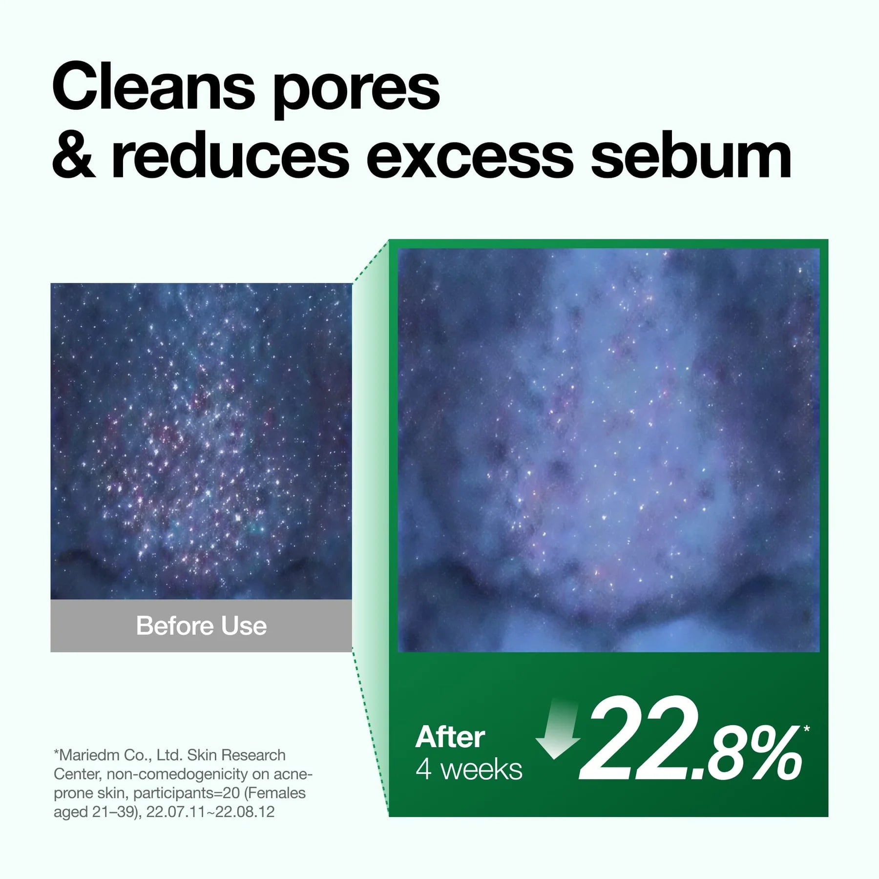 resultados / antes e depois do uso do oleo de limpeza da ANUA Heartleaf Pore Control Cleansing Oil na redução do sebo e limpeza dos poros.