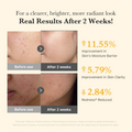 Kojic Acid Turmeric Niacinamide Serum da medicube resultados clinicos obtidos na redução de manchas escuras hiperpgmentação e acne