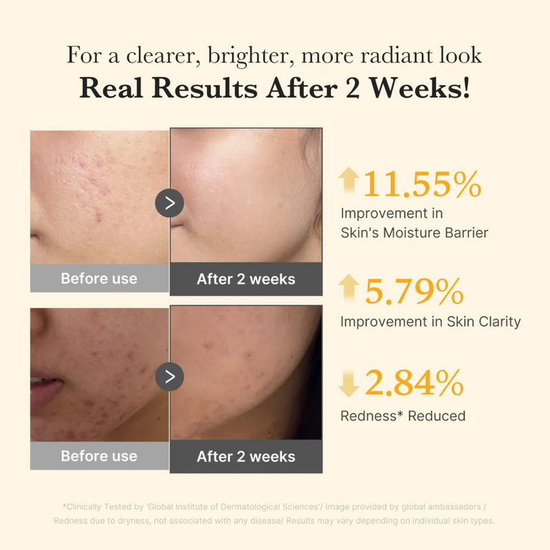 Kojic Acid Turmeric Niacinamide Serum da medicube resultados clinicos obtidos na redução de manchas escuras hiperpgmentação e acne