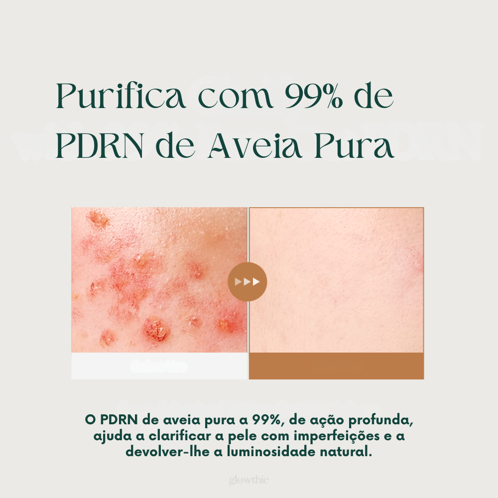 Imagens em grande plano mostram a melhoria da pele: antes, avermelhada e inflamada; depois, mais limpa e suave. O texto promove os benefícios da ação profunda do PDRN de aveia pura a 99%.
