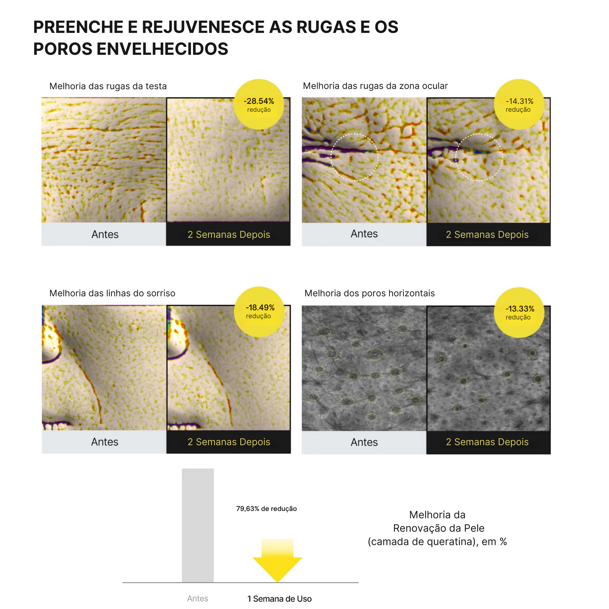 Comparação da textura da pele antes e depois do tratamento. Quatro seções mostram redução de rugas na testa, área dos olhos, linhas de sorriso e tamanho dos poros, com porcentagens