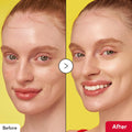 Imagem dividida com um “antes” e “depois” de uma pessoa sorridente sobre um fundo amarelo. O “antes” mostra a textura natural da pele; o “depois” aparece mais lisa e radiante.