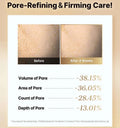 cosrx-vitamin-c-23-serum-textura-glowthie-portugal
Antes e depois Poros do COSRX The Vitamin C 23 Serum