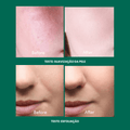 Comparação de pele antes e depois de testes de suavização e esfoliação com cosméticos coreanos