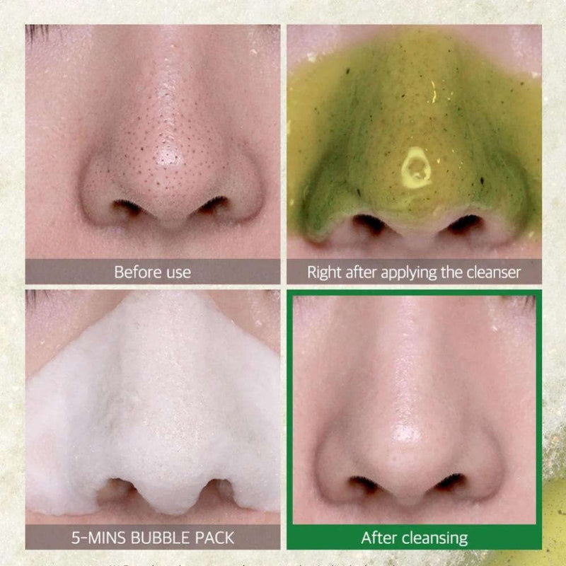 Bye Bye Blackhead Miracle Green Tea Tox Bubble Cleanser Somebymi  Glowthie