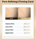 cosrx-vitamin-c-23-serum-textura-glowthie-portugal
Antes e depois Poros do COSRX The Vitamin C 23 Serum