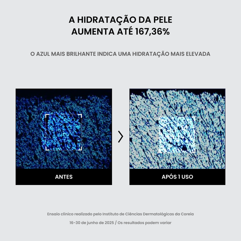 Resultado na pele após uso do creme Dr. Althea Aqua Marine Watery Cream