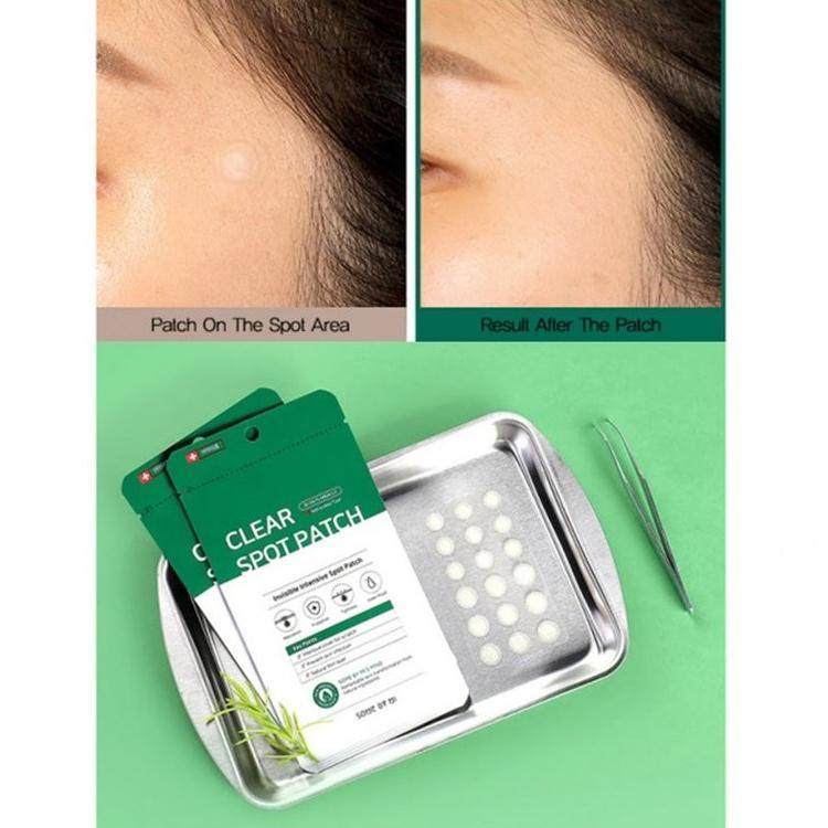 30 Days Miracle Clear Spot Patch Somebymi  Glowthie
