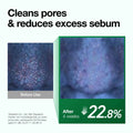 resultados / antes e depois do uso do oleo de limpeza da ANUA Heartleaf Pore Control Cleansing Oil na redução do sebo e limpeza dos poros.