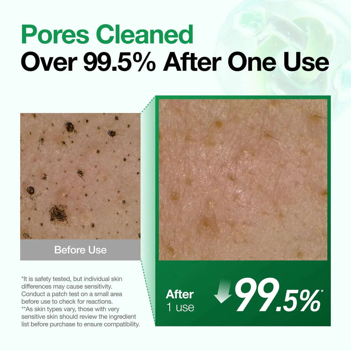 Resultados dos testes de uso da Heartleaf Quercetinol Pore Deep Cleansing Foam da ANUA: após uma unica utilizaççao, os poros ficaram limpos em 99.5%.