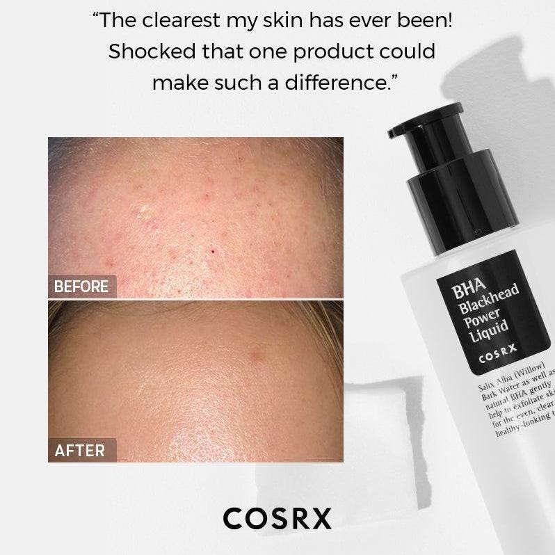 Tratamento esfoliante líquido. Disponível na Glowthie – loja de cosmética coreana em Portugal