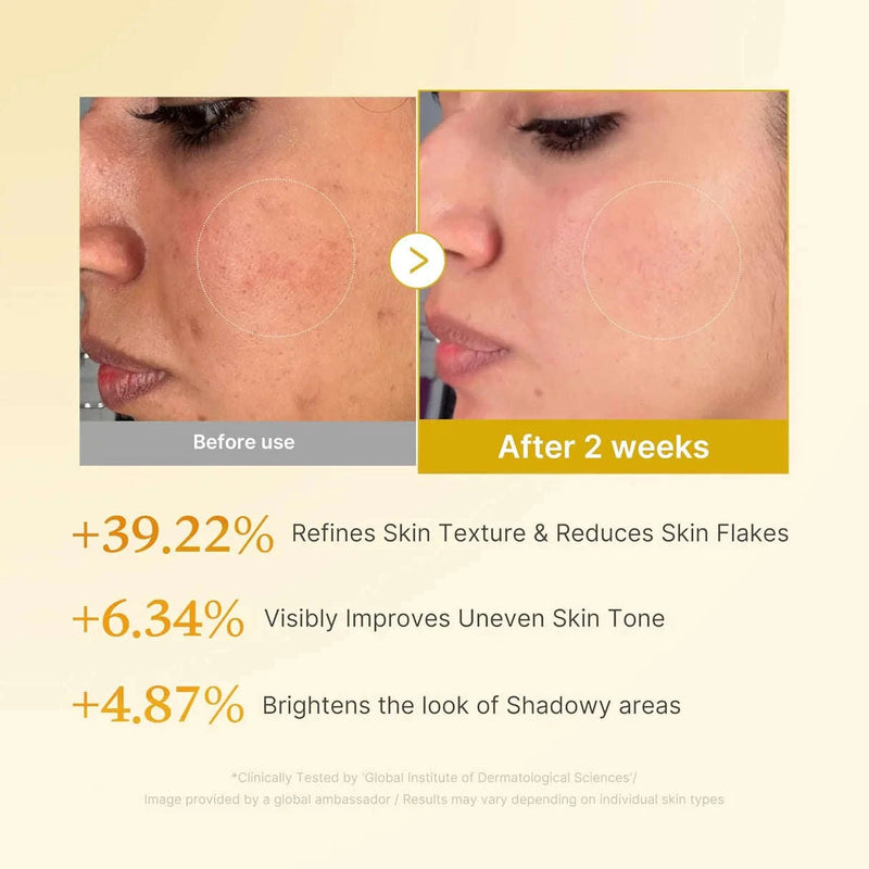 Resultados MEDICUBE Kojic Acid Turmeric Resurfacing Toner 