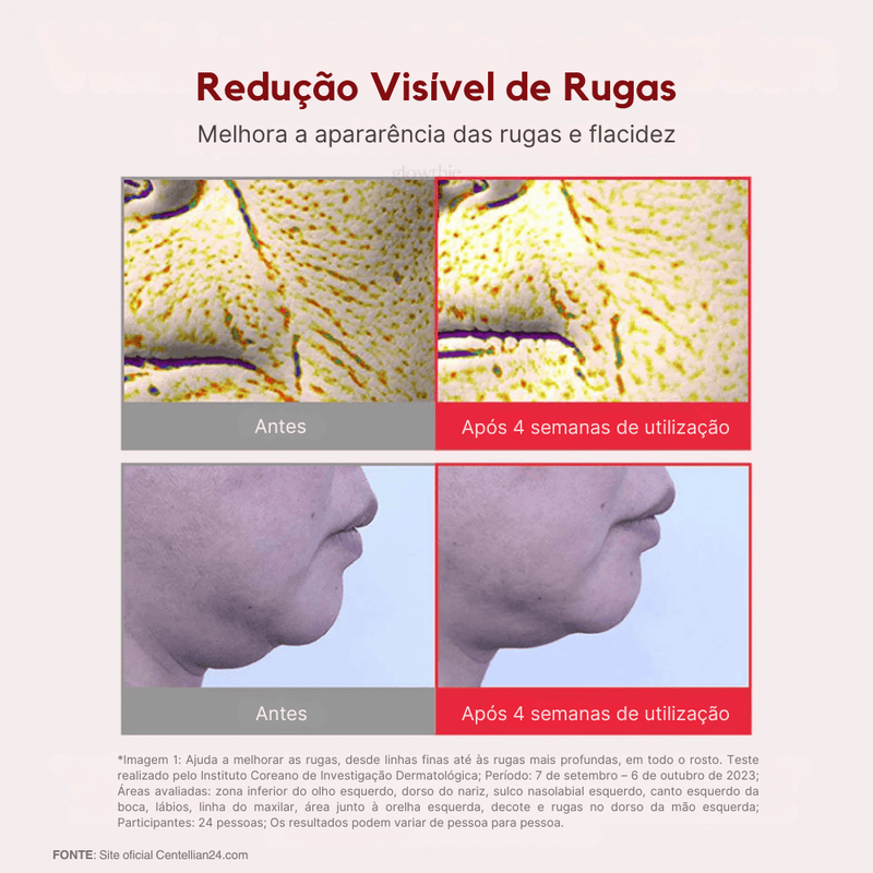 Imagem em close-up de comparação mostrando a redução de rugas: "Antes" à esquerda com linhas mais visíveis, "Após 4 semanas de utilização" à direita com a pele mais lisa.