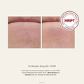 Bean Essence e os testes de irritabilidade na pele, apto para peles sensíveis