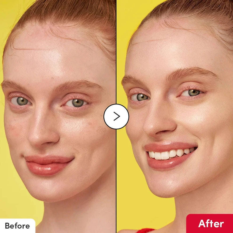 Imagem dividida com um “antes” e “depois” de uma pessoa sorridente sobre um fundo amarelo. O “antes” mostra a textura natural da pele; o “depois” aparece mais lisa e radiante.